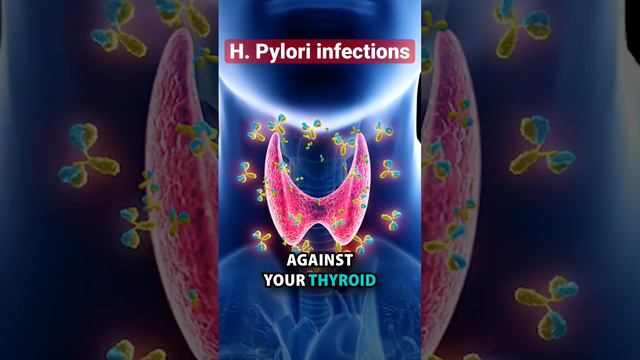 H. Pylori infection can cause autoimmune disease like rheumatoid arthritis, and hypothyroidism! смотреть онлайн