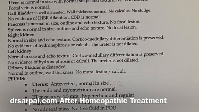 41 mm * 31 mm Left ovary hemorrhagic cyst got dissolved by Homeopathy in 2 months смотреть онлайн