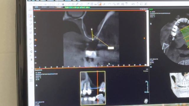 Разбор клиничесткого случая пациента №1 смотреть онлайн