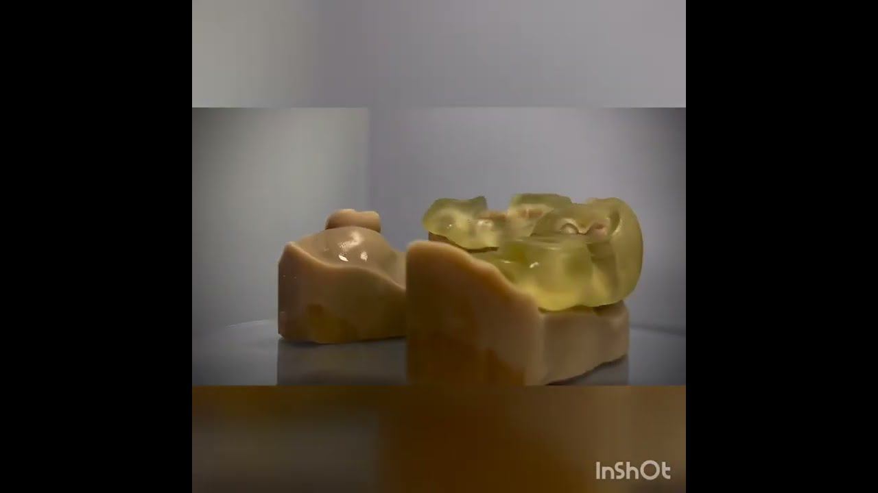 Создание хирургического шаблона для установки дентальных имплантатов смотреть онлайн