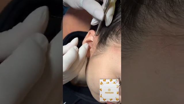 #pirsing #пирсинг piercing industrial Прокол индастриал смотреть онлайн