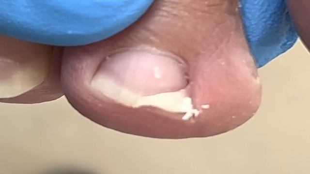 Pretty toes have bad nails, manicured【Xue Yidao】 смотреть онлайн