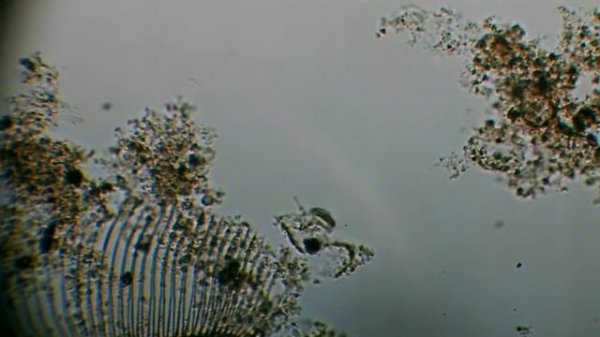 Сказочный активный ил под микроскопом. Activated sludge under the microscope