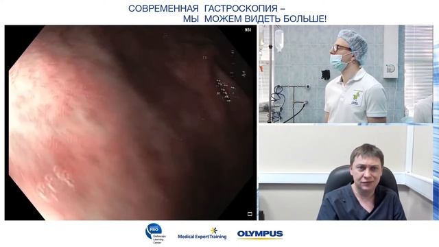 Диагностика раннего рака желудка смотреть онлайн