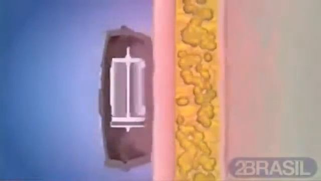 Пояс вибромассажный с эффектом сауны Vibro Shape (Виброшейп)