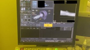 Укладка КТ коленных суставов натив