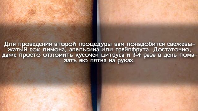 Мгновенное Избавление от Пятен на Лице? В Салоне или Дома смотреть онлайн