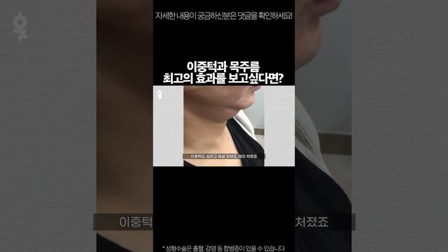 목 주름 / 이중턱 해결하려면?! #shorts смотреть онлайн