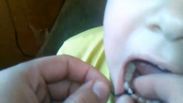 Как вырвать зуб ребенку быстро и БЕЗБОЛЕЗНЕННО смотреть онлайн