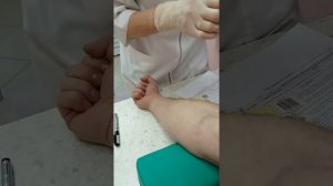 Как происходит забор крови из вены вакуумными пробирками