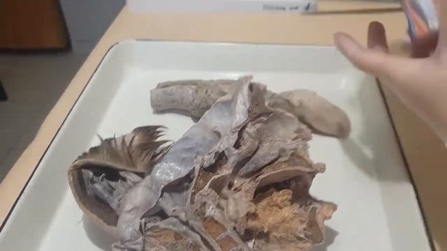 Splanchnology Topic 26 Sagittal section of the head смотреть онлайн