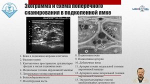 УЗИ сосудов нижних конечностей, Часть 1 / Лайков Алексей Владимирович - врач УЗИ, к.м.н.