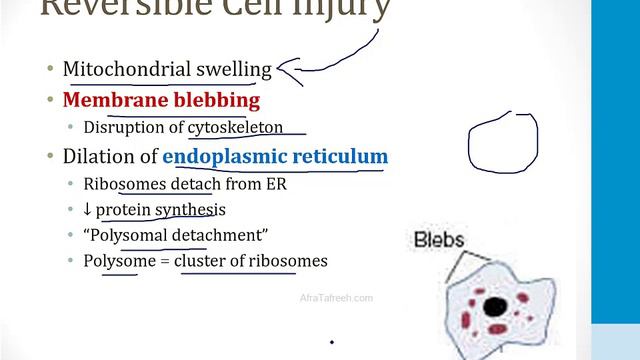 Pathology - 1. General Topics - 2.Cell Injury Atf