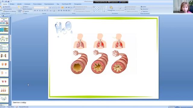 Болезни обезвоживания смотреть онлайн