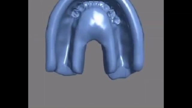 Removable Partial Dentures Steps смотреть онлайн