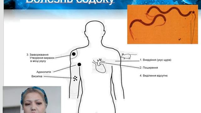 Извитые бактерии