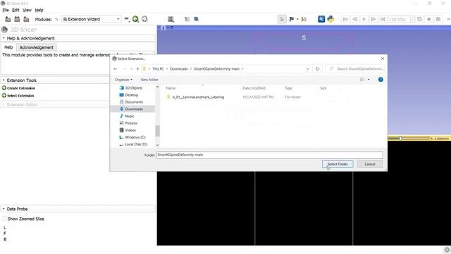 How to install a custom extension module? #00-C. 3D Slicer Tutorial step by step for beginners смотреть онлайн