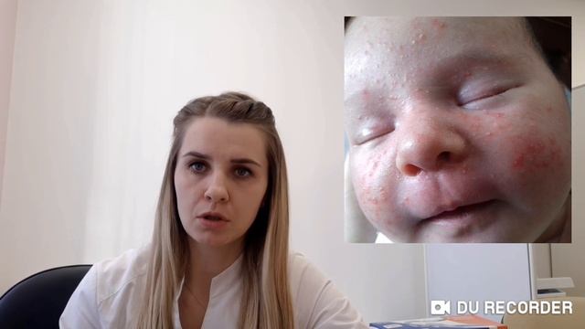 Акне новорожденных! Сыпь у новорожденного ребенка?"Гормональное цветение" смотреть онлайн