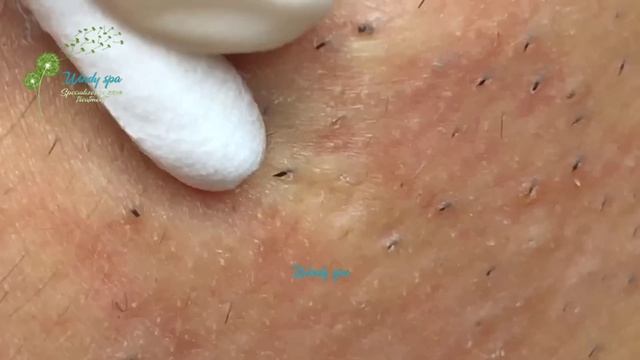 Make Your Day Relaxing with Windy Spa 6#34 смотреть онлайн