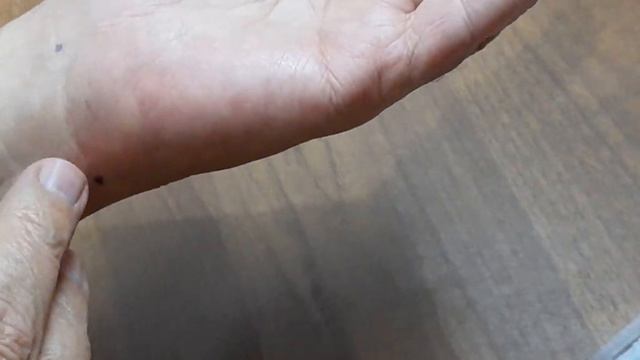 Сам себе иглорефлексотерапевт. смотреть онлайн