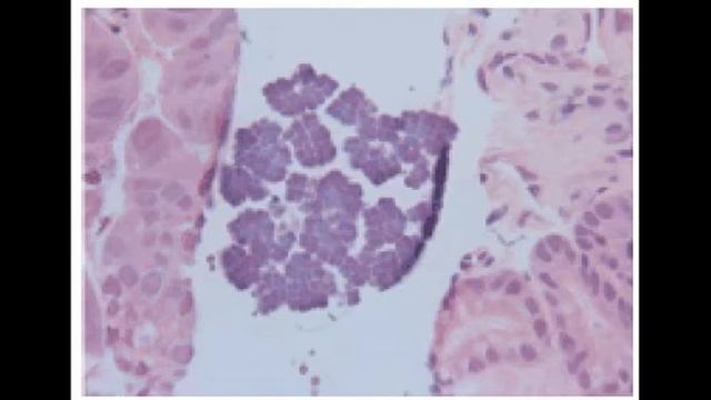 Сарцины смотреть онлайн