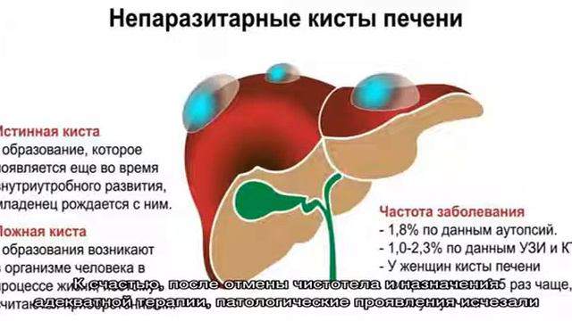 Эффективные способы лечения кисты печени смотреть онлайн