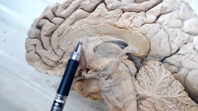 Полушария головного мозга смотреть онлайн