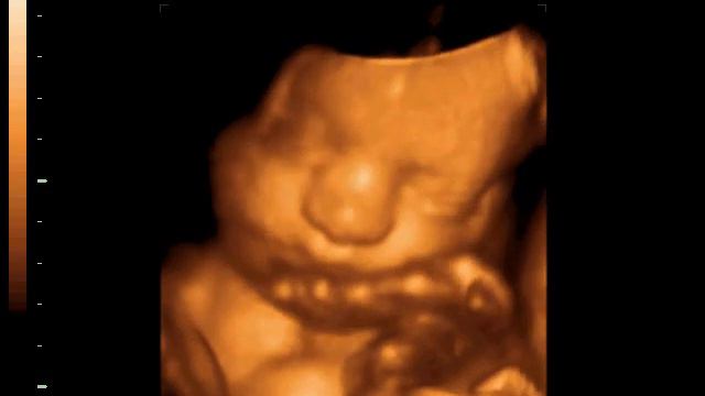 3D LIVE 33 нед смотреть онлайн