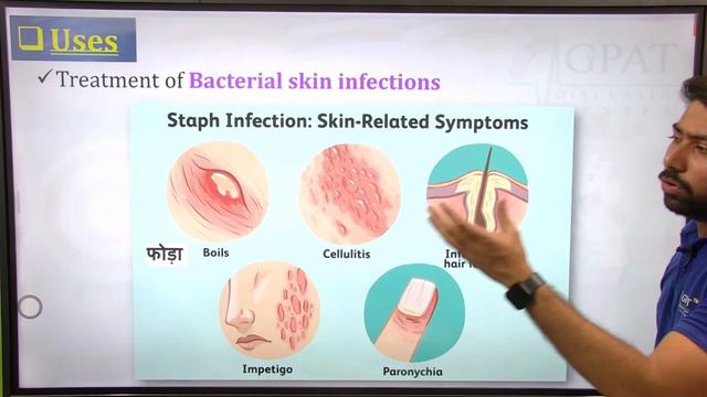 T- Bact Ointment की सम्पूर्ण जानकारी | फोड़े, फुंसी, जलना, घाव, बालतोड़ व Skin Infection में उपयोगी