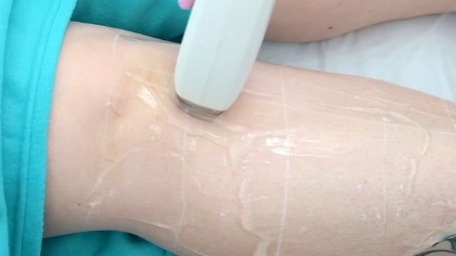 Диодный лазер EPIL LASER 808 - Lasertech смотреть онлайн