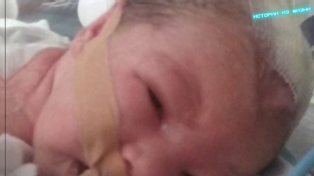 Присмотревшись к голове этого младенца, врачи побледнели!  Такого они еще не видели!