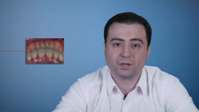 Вся правда о протезировании зубов. Доктор Григорий Кялов | NKClinic