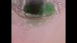 Сувойка - простейшая инфузория ведущая как жизнь одиночки так и в колонии.