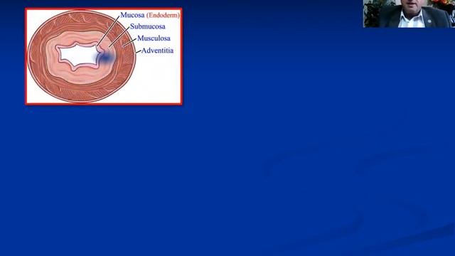 18- GIT"Development of digestive system (Part I)"#GIT смотреть онлайн