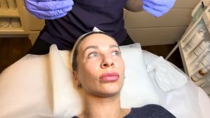 Сделала пилинг PRX T-33. Мое впечатление от процедуры.