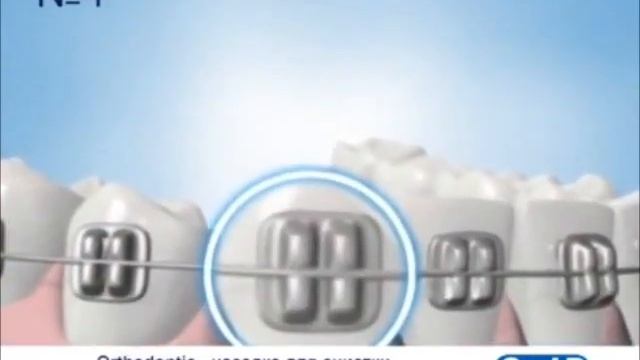 Сменные насадки для электрических зубных щеток Oral-B, купить в интернет-магазине Zubizub смотреть онлайн