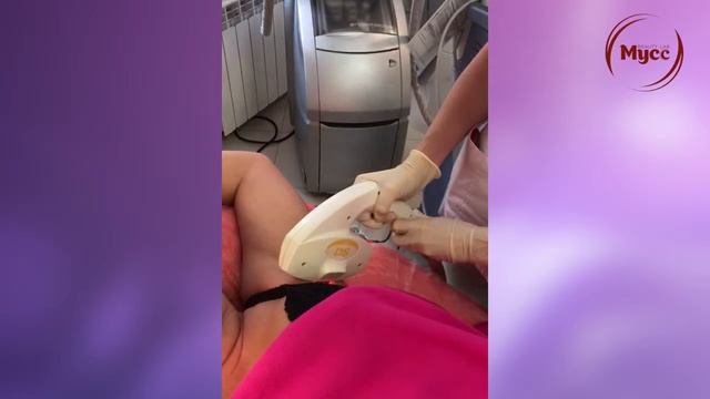 Лазерная Элос эпиляция смотреть онлайн