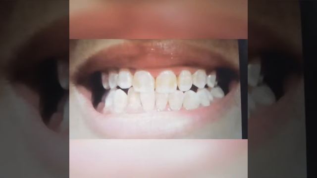 Зачем чистить зубы?? смотреть онлайн