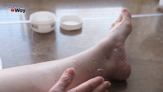 ЛЮБАЯ БОЛЕЗНЬ ОТСТУПИТ, И СУСТАВЫ БОЛЕТЬ ПЕРЕСТАЮТ, ВСЕ БОЛЕЗНИ БОЯТСЯ ЭТОГО КАК ОГНЯ! смотреть онлайн