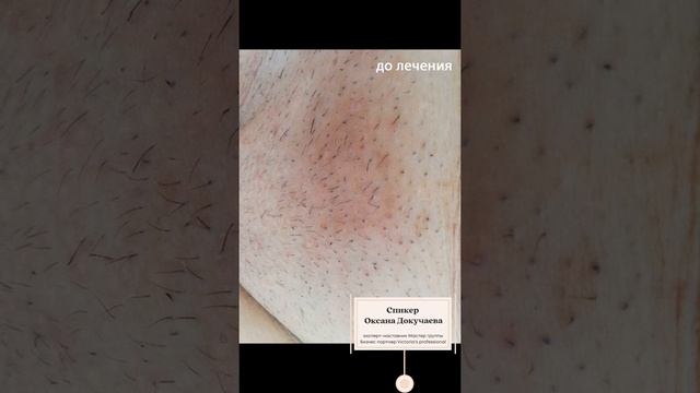 Как работать без перепилинга? Запись прямого эфира от 19.09 смотреть онлайн