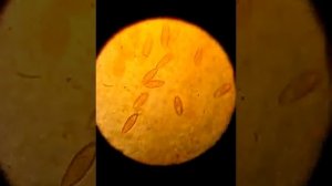 Цисты неизвестного паразита. Unknown parasite cysts.