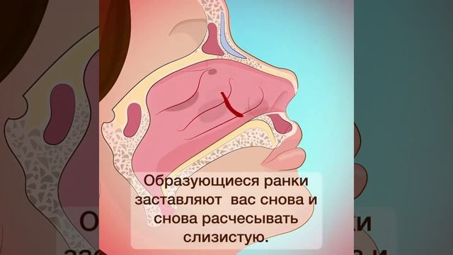 Ковыряться в носу не только некультурно,... смотреть онлайн