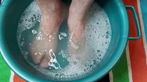 Как быстро удалить мозоли и натоптыши ? Очень простой способ Глубокие  трещины на пятках