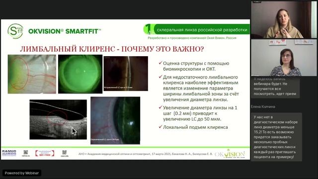 SMARTFIT – новый уникальный дизайн склеральной линзы