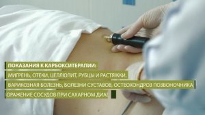 Карбокситерапия в лечении и профилактике.