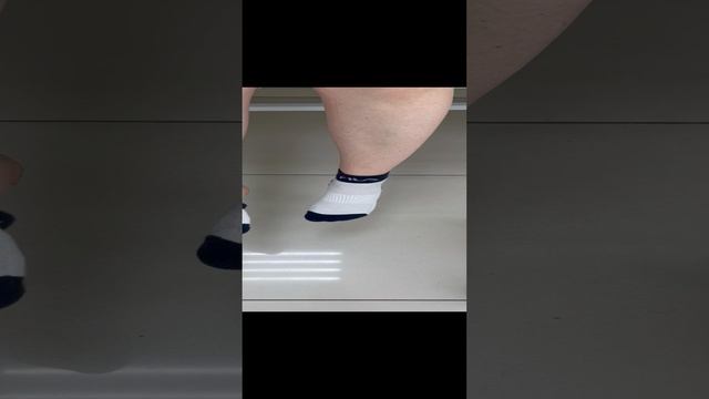 Варикоз прошёл после родов. Вена восстановилась. Узи сосудов. Сосудистый хирург. Флеболог Москва смотреть онлайн