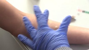 Реакция Манту. Вредна или безопасна?