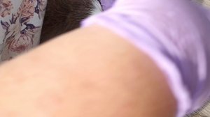 16 клещей сняли с чужой кошки пришедшей за помощью