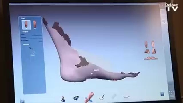 Delcam IQube Orthotic 3D Scanner Interface