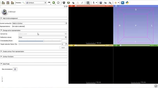 Slicer Python Module Creation Tutorial смотреть онлайн